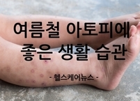 여름철 아토피 피부염에 좋은 생활습관