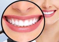 치아 건강을 위한 생활습관 5가지 