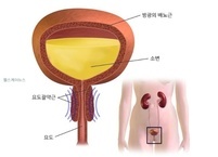 배뇨 장애 주요 증상과 방광 건강 지키는 운동법