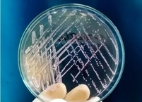 [Info생물] 여름 식중독! 다중인격 대장균이 주범