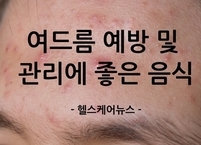 여드름 예방 및 관리에 도움이 되는 음식