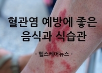 혈관 청소부터 염증 억제까지, 혈관염 예방에 좋은 음식과 식습관