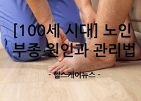 [100세 시대] 가을철 유독 심해진 노인 부종 원인과 관리법