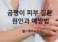 땀과 습기 때문에 더 괴로운 여름! 곰팡이 피부 질환, 원인과 예방법은?