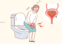 방광염 원인과 증상, 방광염의 치료 및 예방 방법