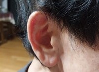 건강해지려면 귀를 못살게 굴어라