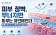 헬스, 세계를 읽다 | 피부 장벽이 무너지면 피부는 왜 예민해질까?