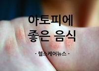 아토피에 좋은 음식