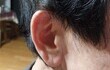 귓구멍은 팔꿈치로 파라