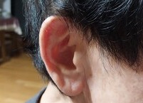 귓구멍은 팔꿈치로 파라