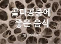 구멍이 숭숭 뼈를 채워주는 골다공증에 좋은 음식