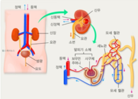 만성 콩팥 질환 자각 증상과 올바른 식생활