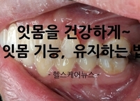 잇몸을 건강하게... 잇몸 질환의 종류와 건강하게 유지하는 법