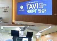 전북대병원, 고난도 심장시술 ‘타비(TAVI) 400례’ 달성해 지역 심혈관 치료 선도