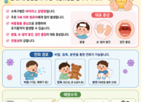 진안군, 여름철 수족구병 확산에 따른 영유아 감염 예방 수칙 준수 당부