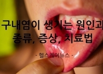 구내염이 생기는 원인과 종류, 증상, 치료법 