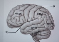 내 몸에 숨어 있는 뇌경색 찾아내는 방법