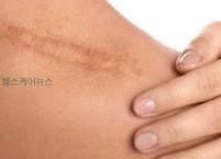 내 몸이 기상청인 기상병의 예방과 치료