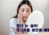 판다 눈 싫어! 다크서클 원인과 예방