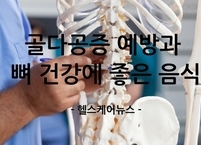 골다공증 예방과 뼈 건강에 도움을 주는 음식
