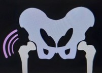 관절 통증 이렇게 해보세요