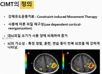 강제 유도 운동치료란?