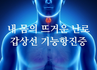 내 몸의 뜨거운난로 갑상선 기능항진증