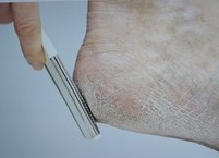 각질, 벗겨내지 말고 보존하세요