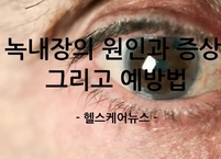 녹내장의 원인과 증상, 그리고 현명한 예방법 